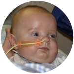 a young infant with a nose tube